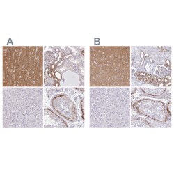 Invitrogen&trade;&nbsp;Drebrin Polyclonal Antibody