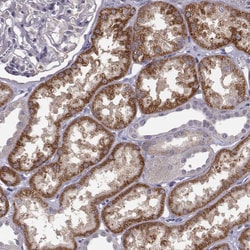 Invitrogen KMO Polyclonal Antibody 100 &mu;L; Unconjugated:Antibodies,