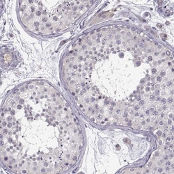 Invitrogen KMO Polyclonal Antibody 100 &mu;L; Unconjugated:Antibodies,