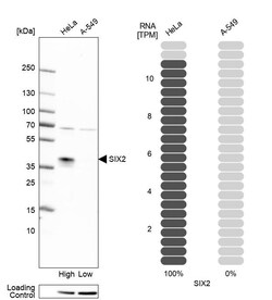 Invitrogen SIX2 Polyclonal Antibody 100 &mu;L; Unconjugated:Antibodies,