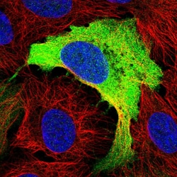 Invitrogen RRM2 Polyclonal Antibody 100 &mu;L; Unconjugated:Antibodies,