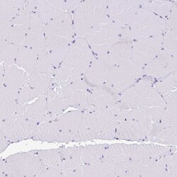 Invitrogen RRM2 Polyclonal Antibody 100 &mu;L; Unconjugated:Antibodies,