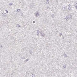 Invitrogen CSN1S1 Polyclonal Antibody 100 &mu;L; Unconjugated:Antibodies,