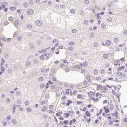 Invitrogen CSN1S1 Polyclonal Antibody 100 &mu;L; Unconjugated:Antibodies,