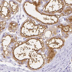 Invitrogen CSN1S1 Polyclonal Antibody 100 &mu;L; Unconjugated:Antibodies,