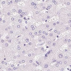 Invitrogen CSN1S1 Polyclonal Antibody 100 &mu;L; Unconjugated:Antibodies,