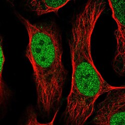Invitrogen AP2 gamma Polyclonal Antibody 100 &mu;L; Unconjugated:Antibodies,