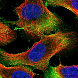 Invitrogen UBE2S Polyclonal Antibody 100 &mu;L; Unconjugated:Antibodies,