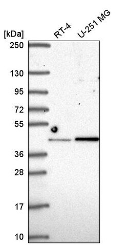 Invitrogen IRF2 Polyclonal Antibody 100 &mu;L; Unconjugated:Antibodies,