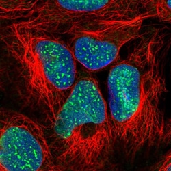 Invitrogen SUZ12 Polyclonal Antibody 100 &mu;L; Unconjugated:Antibodies,