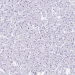 Invitrogen SUZ12 Polyclonal Antibody 100 &mu;L; Unconjugated:Antibodies,