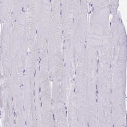 Invitrogen SUZ12 Polyclonal Antibody 100 &mu;L; Unconjugated:Antibodies,