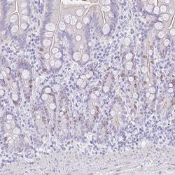 Invitrogen SUZ12 Polyclonal Antibody 100 &mu;L; Unconjugated:Antibodies,