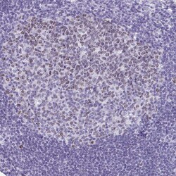 Invitrogen SUZ12 Polyclonal Antibody 100 &mu;L; Unconjugated:Antibodies,