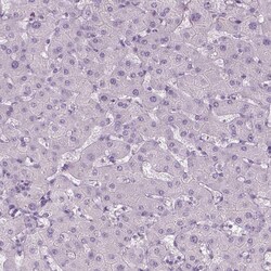 Invitrogen TMEM16B Polyclonal Antibody 100 &mu;L | Buy Online | Invitrogen&trade; | Fisher Scientific
