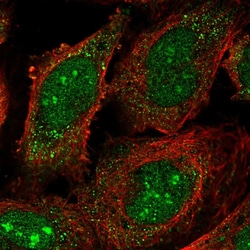 Invitrogen Cerebral Protein 1 Polyclonal Antibody 100 &mu;L; Unconjugated:Antibodies,