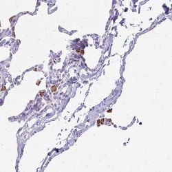 Invitrogen Tartrate Resistant Acid Phosphatase Polyclonal Antibody 100