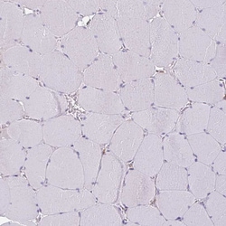 Invitrogen Tartrate Resistant Acid Phosphatase Polyclonal Antibody 100