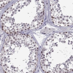 Invitrogen MED26 Polyclonal Antibody 100 &mu;L; Unconjugated:Antibodies,