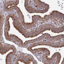 Invitrogen DVL3 Polyclonal Antibody 100 &mu;L; Unconjugated:Antibodies,