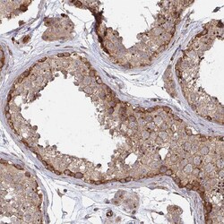 Invitrogen DVL3 Polyclonal Antibody 100 &mu;L; Unconjugated:Antibodies,