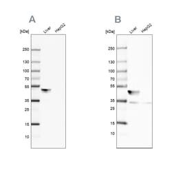 Invitrogen BHMT Polyclonal Antibody 100 &mu;L; Unconjugated:Antibodies,