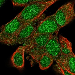 Invitrogen BACH2 Polyclonal Antibody 100 &mu;L; Unconjugated:Antibodies,
