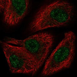 Invitrogen TOX2 Polyclonal Antibody 100 &mu;L; Unconjugated:Antibodies,