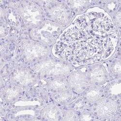 Invitrogen TNNT1 Polyclonal Antibody 100 &mu;L | Buy Online | Invitrogen&trade; | Fisher Scientific