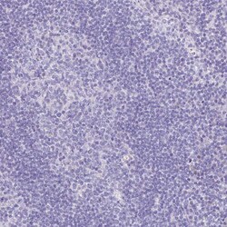 Invitrogen TNNT1 Polyclonal Antibody 100 &mu;L | Buy Online | Invitrogen&trade; | Fisher Scientific