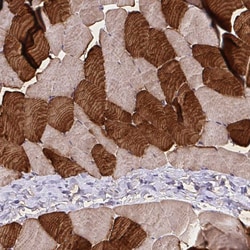 Invitrogen TNNT1 Polyclonal Antibody 100 &mu;L | Buy Online | Invitrogen&trade; | Fisher Scientific