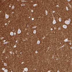 Invitrogen SIRP alpha Polyclonal Antibody 100 &mu;L; Unconjugated:Antibodies,