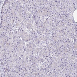 Invitrogen SIRP alpha Polyclonal Antibody 100 &mu;L; Unconjugated:Antibodies,