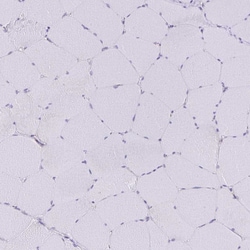 Invitrogen SIRP alpha Polyclonal Antibody 100 &mu;L; Unconjugated:Antibodies,