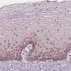 Invitrogen STAT3 Polyclonal Antibody 100 &mu;L; Unconjugated:Antibodies,