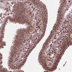 Invitrogen STAT3 Polyclonal Antibody 100 &mu;L; Unconjugated:Antibodies,