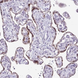 Invitrogen CMPK1 Polyclonal Antibody 100 &mu;L; Unconjugated:Antibodies,