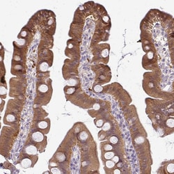 Invitrogen CMPK1 Polyclonal Antibody 100 &mu;L; Unconjugated:Antibodies,