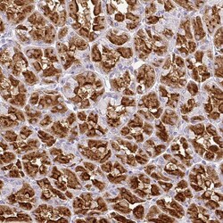 Invitrogen CMPK1 Polyclonal Antibody 100 &mu;L; Unconjugated:Antibodies,