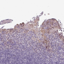 Invitrogen CMPK1 Polyclonal Antibody 100 &mu;L; Unconjugated:Antibodies,