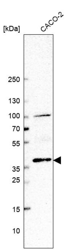 Invitrogen BMP-2 Polyclonal Antibody 100 &mu;L; Unconjugated:Anticuerpos