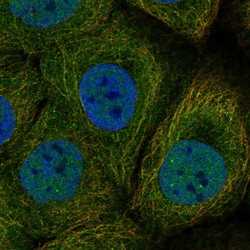 Invitrogen DAPL1 Polyclonal Antibody 100 &mu;L; Unconjugated:Antibodies,