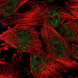 Invitrogen WDR19 Polyclonal Antibody 100 &mu;L | Buy Online | Invitrogen&trade; | Fisher Scientific