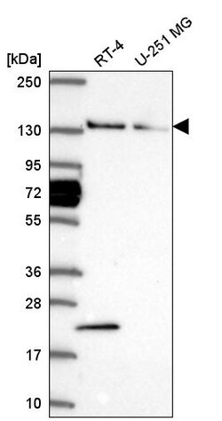 Invitrogen WDR19 Polyclonal Antibody 100 &mu;L | Buy Online | Invitrogen&trade; | Fisher Scientific
