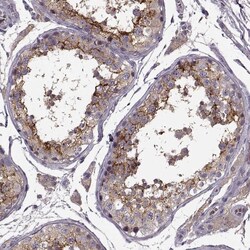 Invitrogen SLC52A3 Polyclonal Antibody 100 &mu;L; Unconjugated:Antibodies,