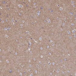 Invitrogen Clathrin Heavy Chain Polyclonal Antibody 100 &mu;L; Unconjugated:Antibodies,