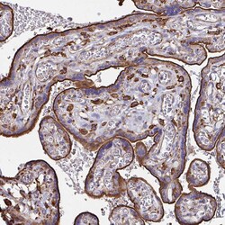 Invitrogen Clathrin Heavy Chain Polyclonal Antibody 100 &mu;L; Unconjugated:Antibodies,