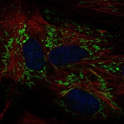 Invitrogen ALDH1L2 Polyclonal Antibody 100 &mu;L; Unconjugated:Antibodies,