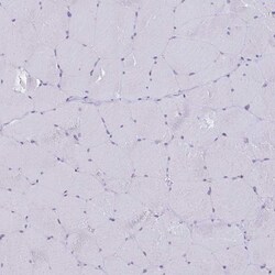 Invitrogen ITGB1 Polyclonal Antibody 100 &mu;L; Unconjugated:Antibodies,