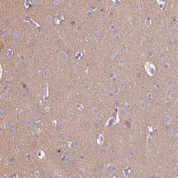 Invitrogen CAPS1 Polyclonal Antibody 100 &mu;L | Buy Online | Invitrogen&trade; | Fisher Scientific